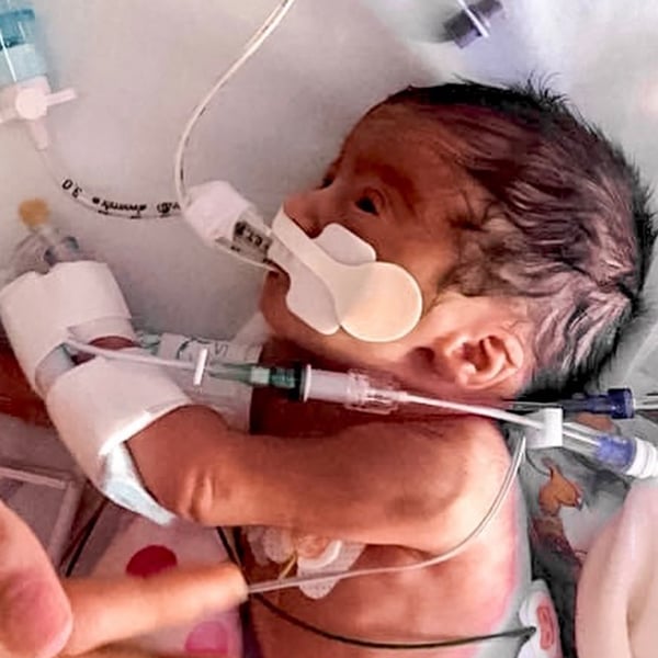 World Prematurity Day – My Story